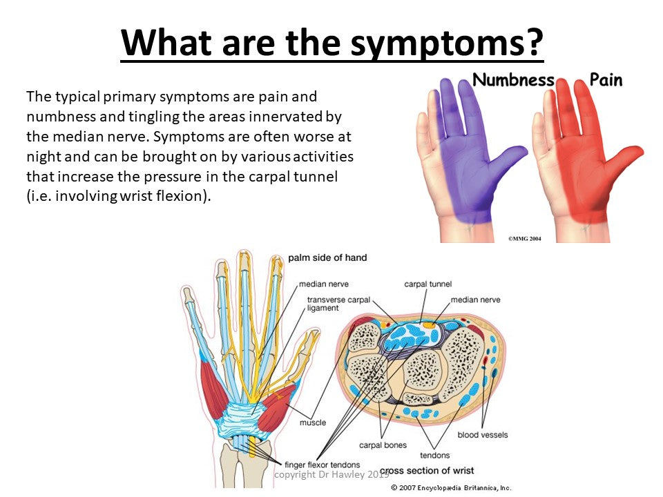 
                  
                    Understanding Carpal Tunnel Syndrome 1.5 CEs
                  
                