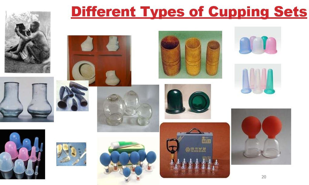 
                  
                    Introduction to Cupping 2.0 CEs NCBTMB approved
                  
                